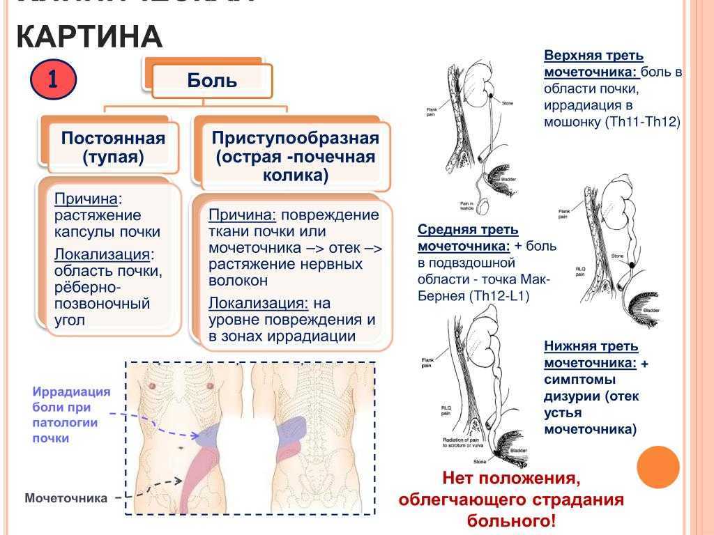 Взаимосвязь между болью в спине и заболеваниями жкт