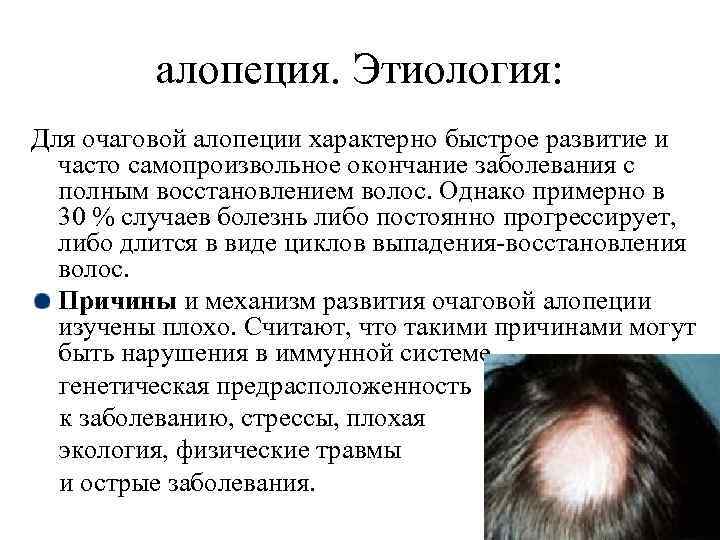 Алопеция у детей - диагностика и лечение, причины возникновения - детский дерматолог см-клиника