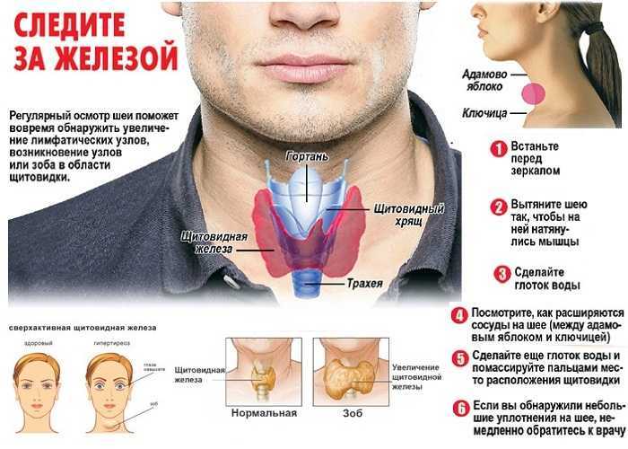 Лечение кишечной непроходимости
