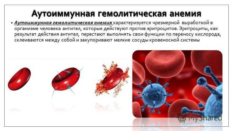 Иммунный гемолиз. Гемолиз при аутоиммунная гемолитическая анемия. Аутоиммунная гемолитическая анемия патогенез. Тепловая аутоиммунная гемолитическая анемия. Механизм развития аутоиммунной гемолитической анемии.