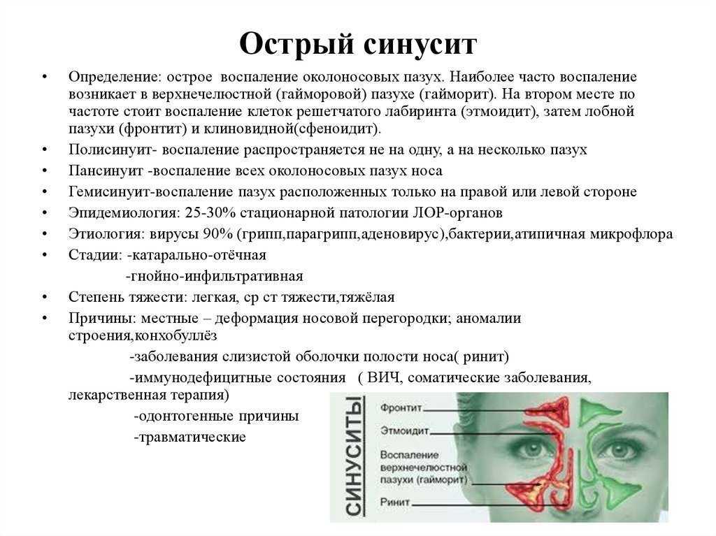Фронтит