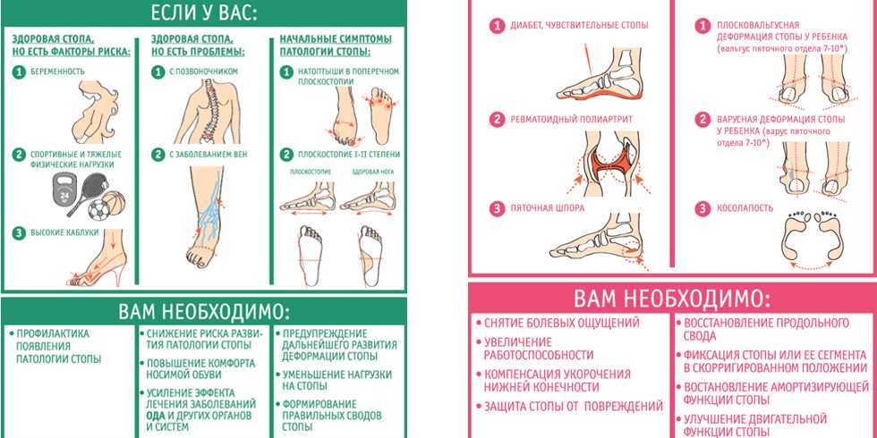 Стопа инструкция по применению. Классификация ортопедических заболеваний стопы. Ортопедические болезни стопы. Нарушение положения стопы.