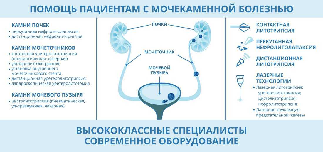 Камни в почках лечение таблетками разбивающие камни у женщин препараты схема