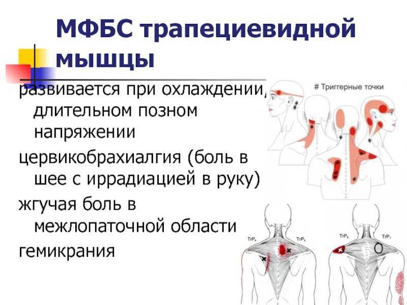 Быстрое непроизвольное стереотипное сокращение мышц, однообразное, напоминающее обычные движения - происходит само по себе, без воли человека