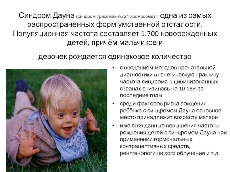 Синдром дауна - признаки, причины, симптомы, лечение и профилактика - idoctor.kz
