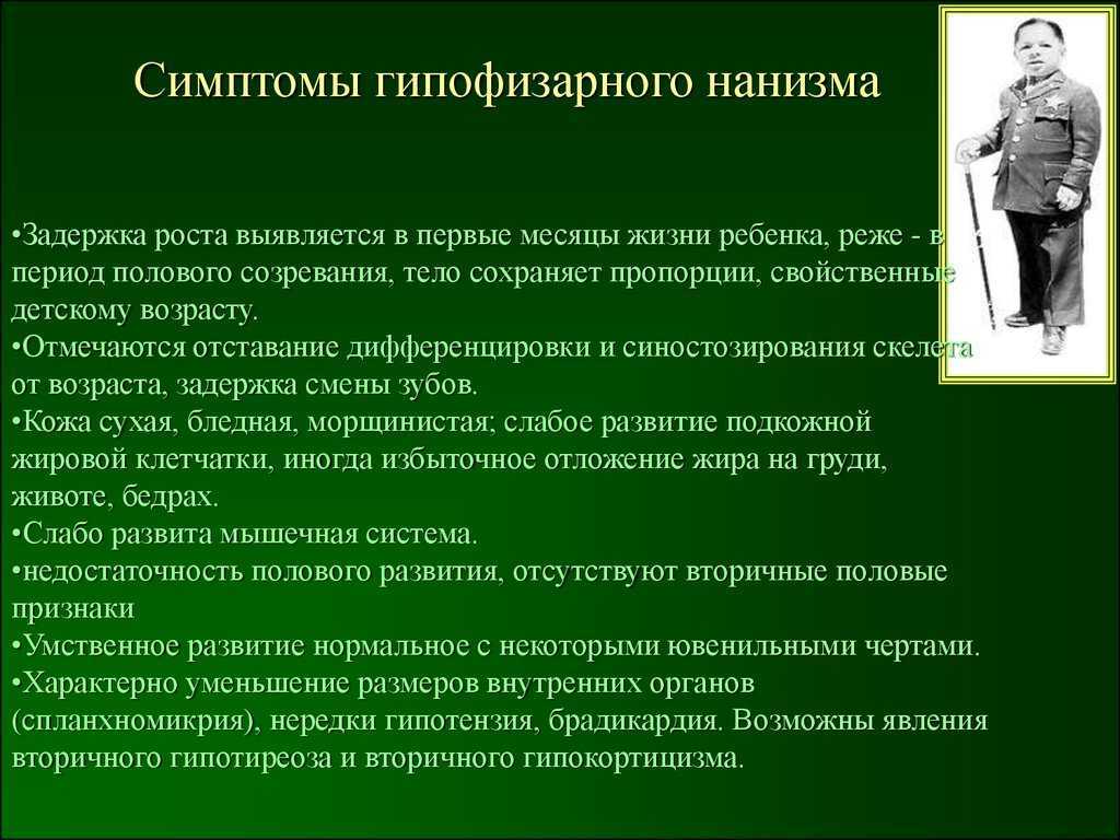 Карликовость гормон. Гипофизарный нанизм (карликовость). Гипофизарный нанизм симптомы. Гипофизарная карликовость проявления. Гипофизарный карликовый рост признаки.