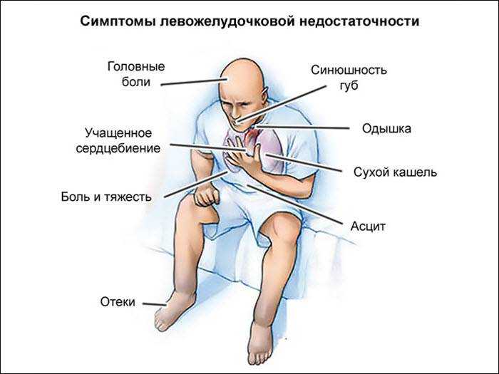 Одышка