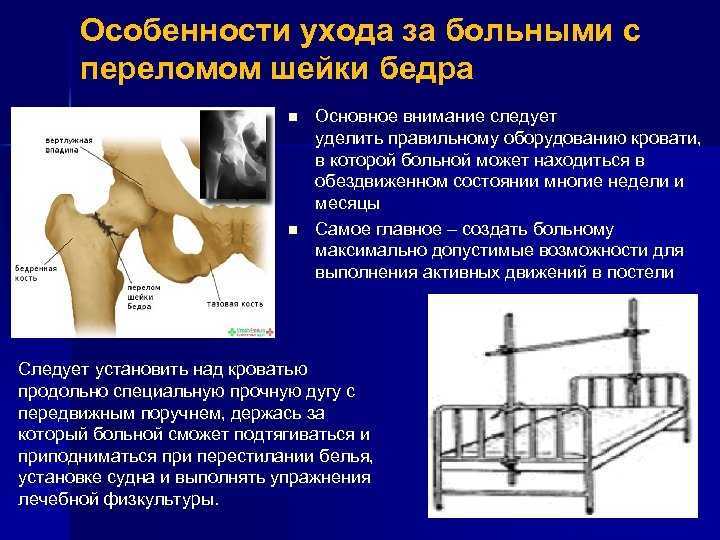 Перелом шейки бедра презентация