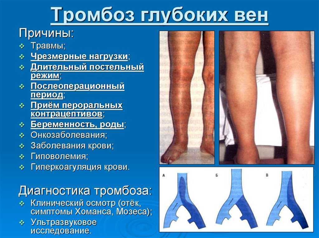Анти-эйдж программы для красивой тонкой шеи без второго подбородка и морщин