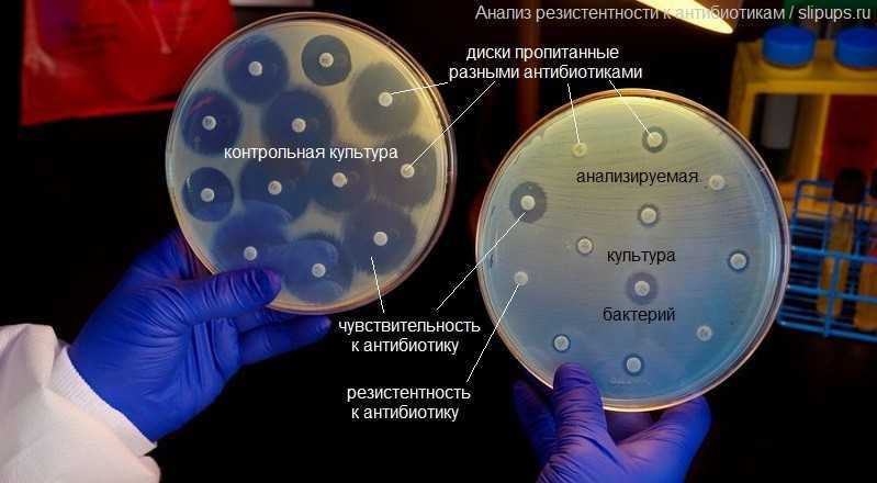Восстановления микрофлоры кишечника после антибактериальных препаратов