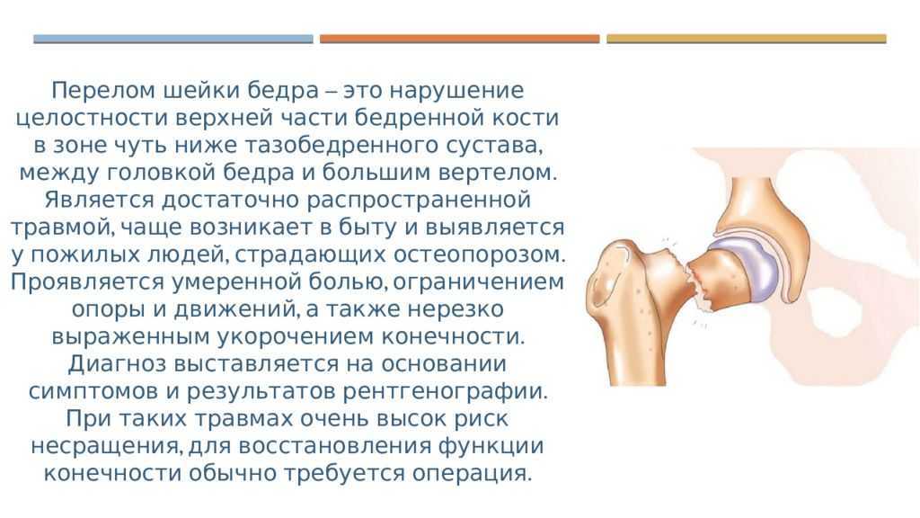 Болезнь легга-кальве-пертеса - «доктор гален» консультация ортопеда, травматолога, ревматолога. обследование. лечение. медицинские изделия.