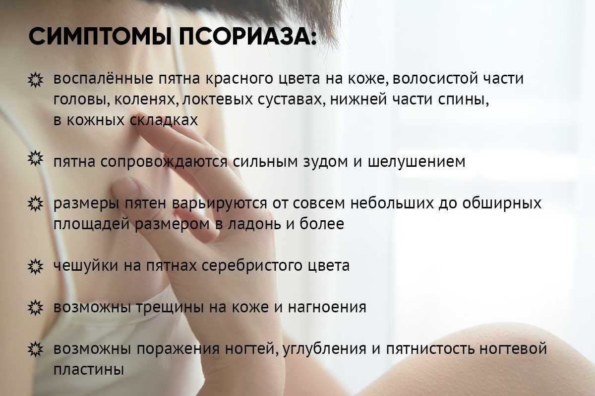 Отличия псориаза и дерматита – как определить заболевание