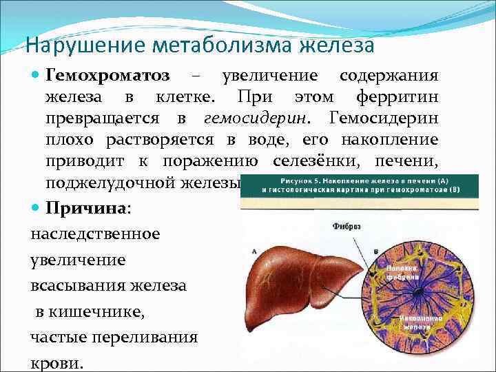 Нарушение обмена веществ печени. Нарушение обмена железа. Нарушение метаболизма железа. Нарушение обмена железа биохимия. Расстройства в организме, связанные с нарушением обмена железа.