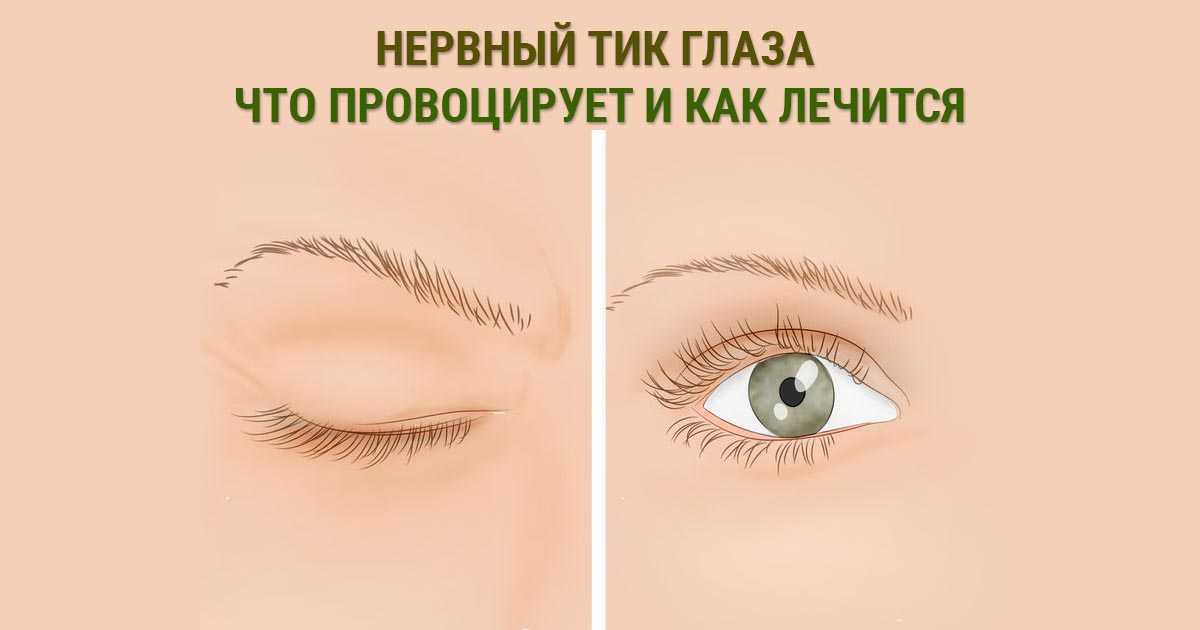 Причины подергивания глаза. Нервный тик левого глаза. Массаж при нервном тике глаза у взрослого.