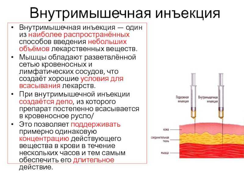 Утром или вечером колоть. Внутримышечная инъекция максимальный объем раствора. Схема внутримышечных инъекций масляных растворов. Внутримышечная инъекция глубина введения иглы. Объем препарата внутримышечное Введение.