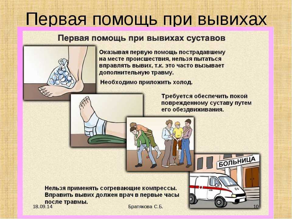 Как жить с эндопротезом тазобедренного сустава: практические советы - нолтрекс.