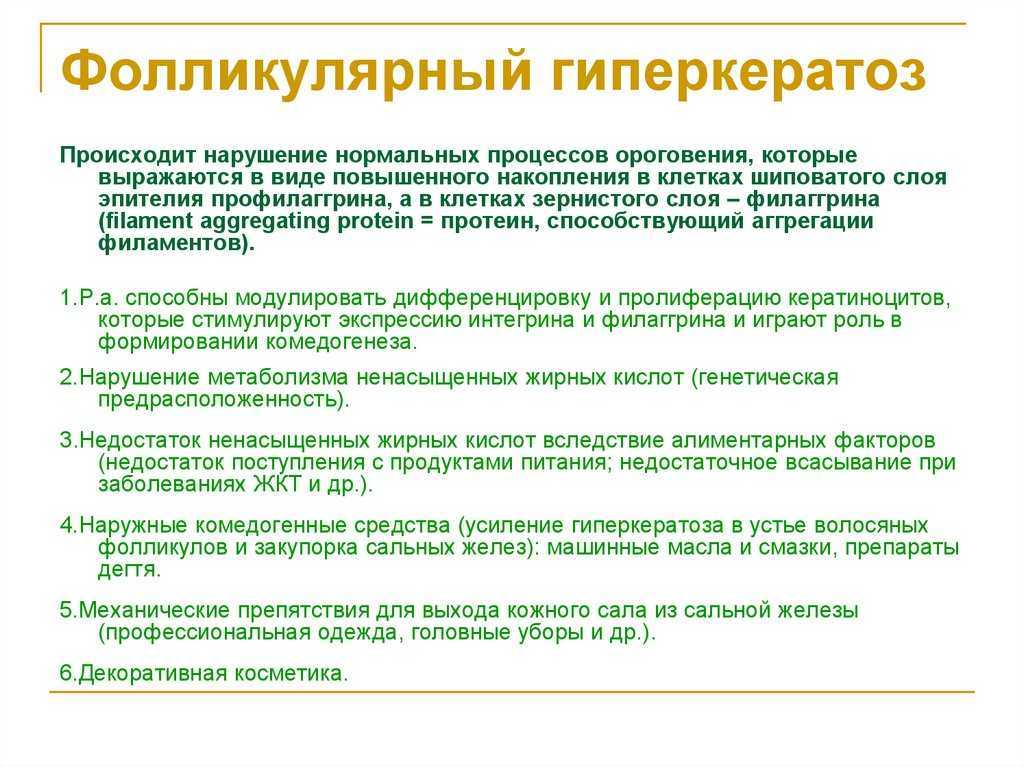 Сухая мозоль: удаление, лечение, профилактика