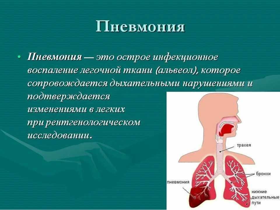 Пневмония у детей презентация