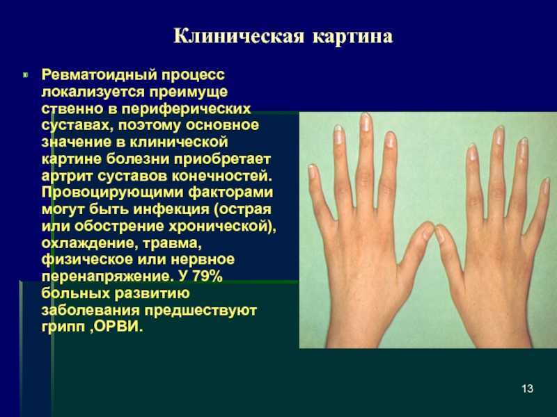 Заболевания суставов. симптомы и причины. | здравствуй
