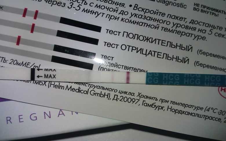 Анализы на зппп (иппп)