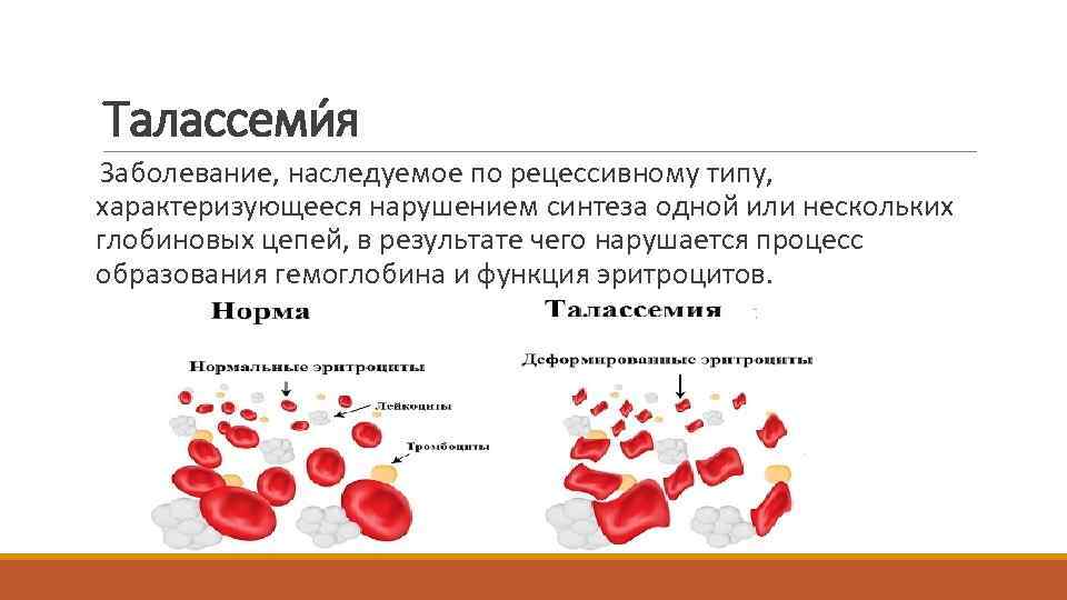Анемия (малокровие): симптомы, лечение, степени, виды