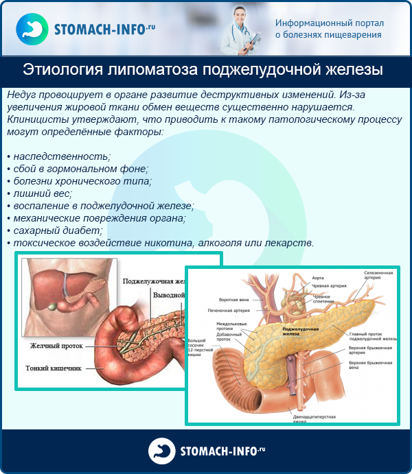 Доброкачественные опухоли мягких тканей