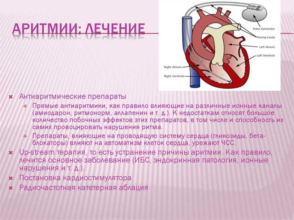 Ибс аритмический вариант карта вызова