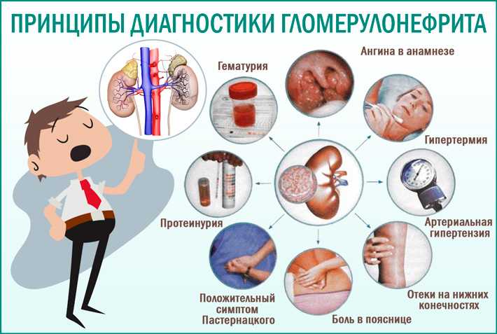 Хроническая почечная недостаточность у детей