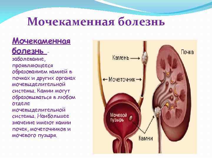 Лечение заболеваний мочеполовой системы