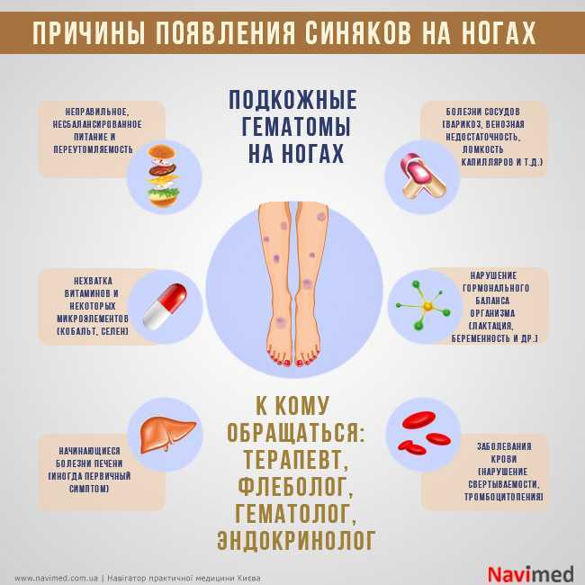 Сосудистые звездочки: симптом серьезных заболеваний