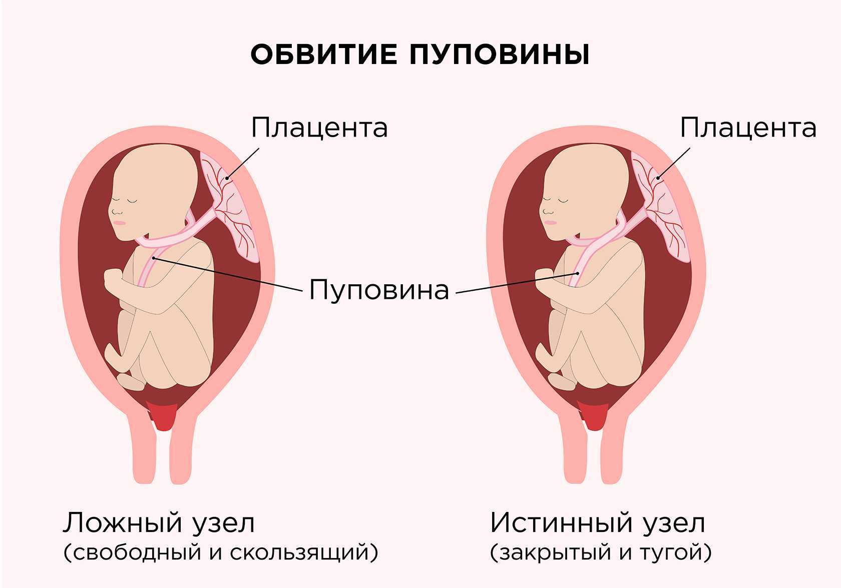 Кардиотокография (ктг). исследование и запись сердцебиения ребенка