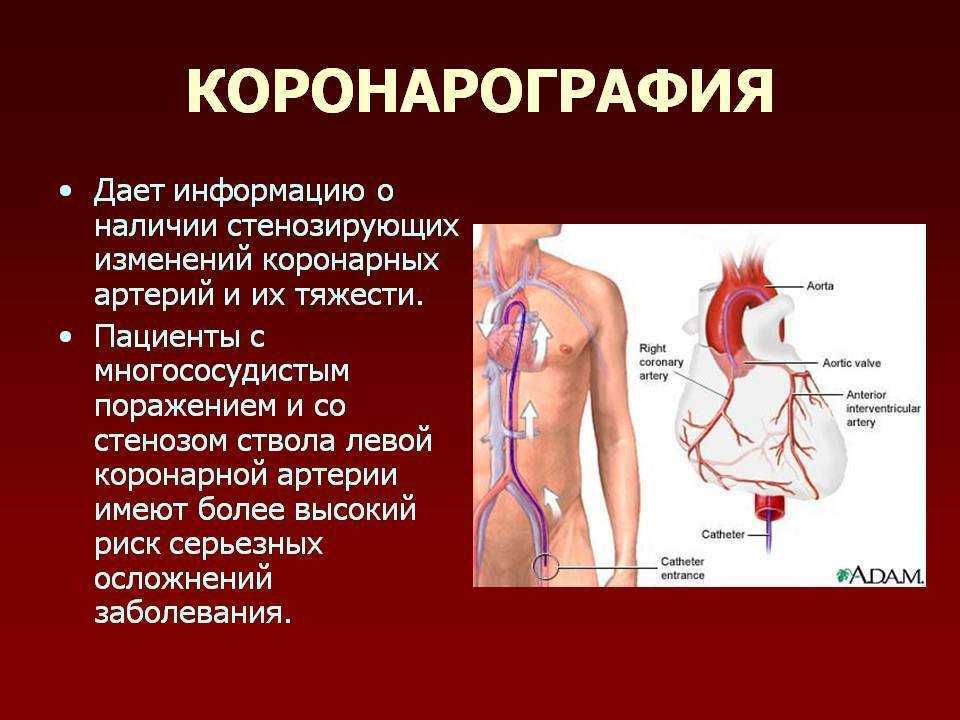 Обследования при подозрении на сердечно-сосудистые заболевания. ранняя диагностика ссз.