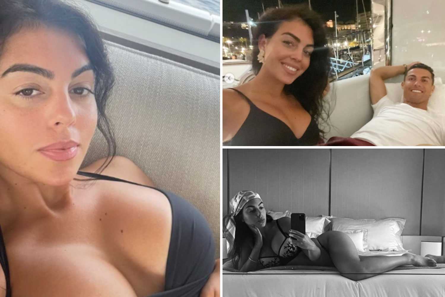 Делала ли ирина шейк пластику?