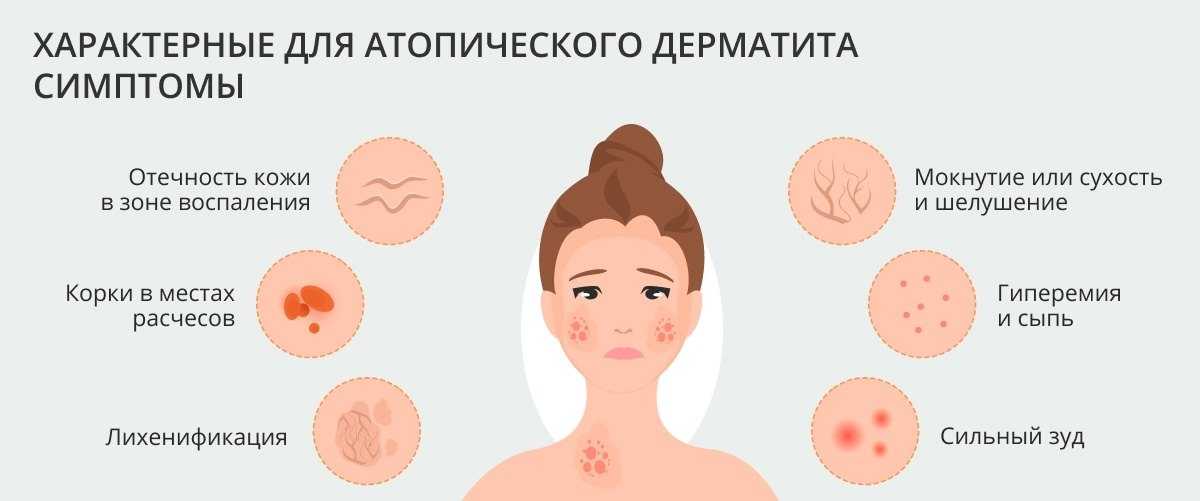 Хроническое кожное заболевание неврогенной природы, протекающее по типу аллергии и проявляющееся высыпаниями и сильным зудом