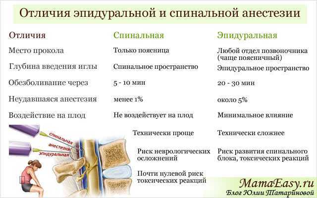 Эпидуральная анестезия