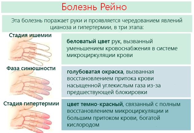 Комплекс симптомов, которые развиваются вследствие резкого сужения сосудов под действием стресса или холода и чаще всего при нем поражаются сосуды пальцев рук, ног, подбородка