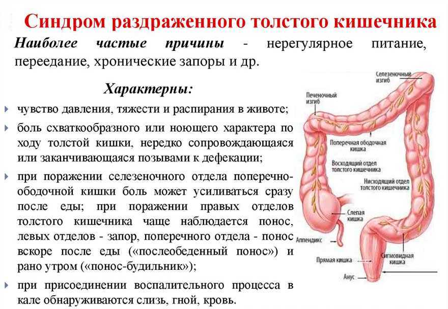 Сигмоидит схема лечения