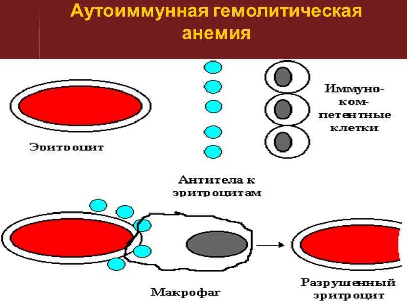 Иммунный гемолиз. Гемолитическая анемия патогенез схема. Гемолиз эритроцитов схема. Аутоиммунная гемолитическая анемия патогенез. Иммуноопосредованная гемолитическая анемия.