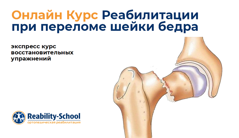 Перелом шейки бедренной кости