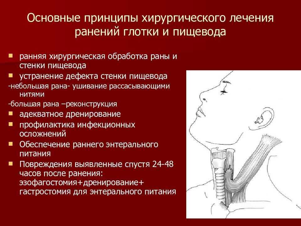 Как избавиться от изжоги?