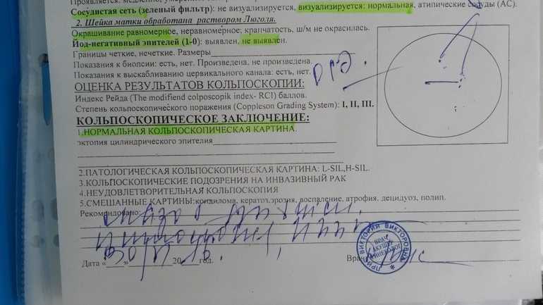 Кольпоскопия - что это такое, цена, как и где сделать