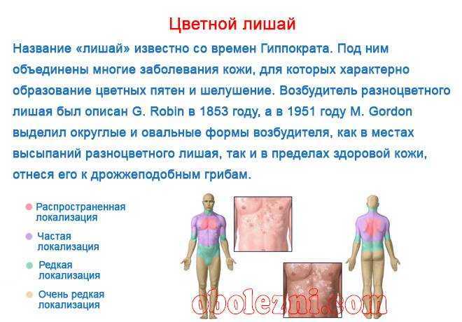 Опоясывающий лишай | университетская клиника