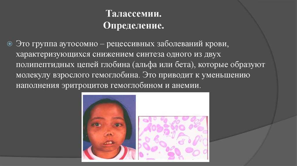 Гемоглобинопатия - аномальные варианты гемоглобина | университетская клиника