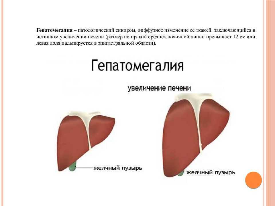 Сосудистый рисунок усилен печени у ребенка причины