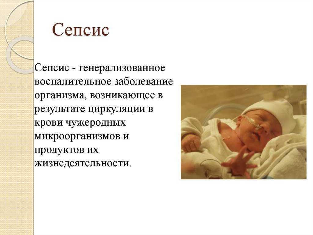 Генерализованное гнойные заболевания новорожденных. Болезни новорожденных. Сепсис новорожденных презентация. Инфекционные заболевания новорожденных.