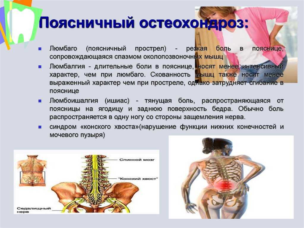 Люмбаго с ишиасом карта вызова скорой