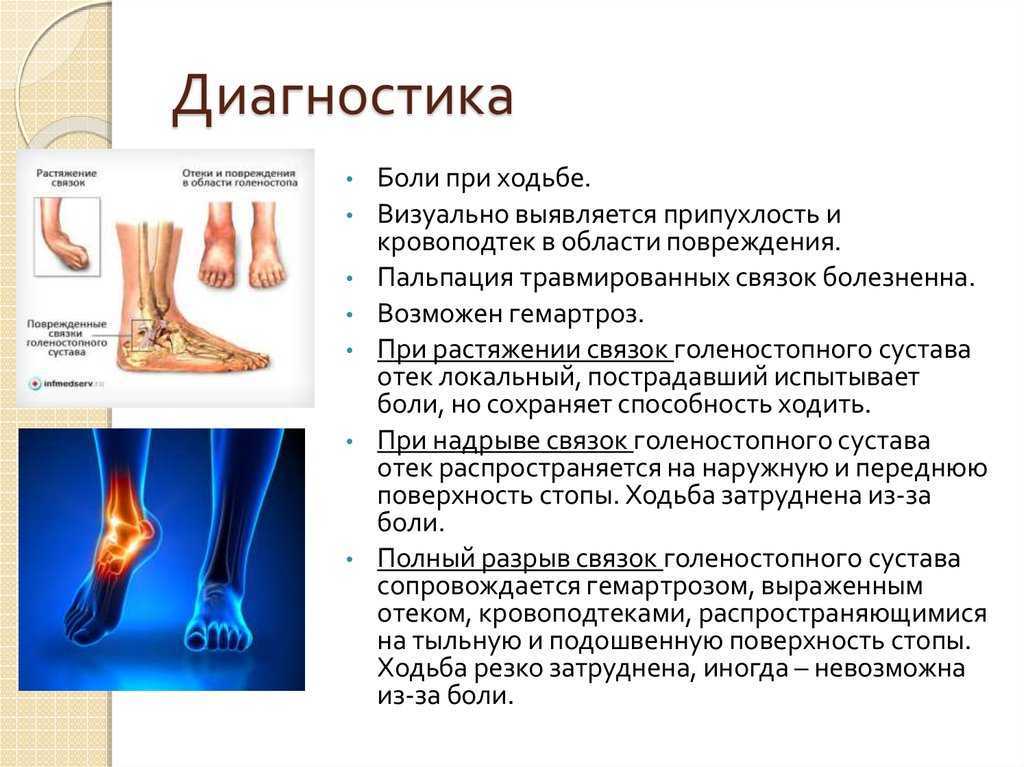 Болезни суставов