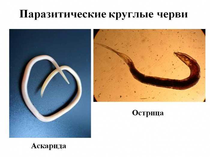 Гельминтозное заболевание, которое вызывается червем-нематодой небольших размеров, самка червя откладывает личинки, которые попадают в мышцы зараженного человека, растут и развиваются в них, а позже приобретают спиралевидную форму и покрываются капсулой