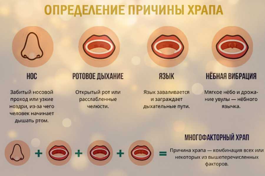 Лечение храпа и синдрома обструктивного апноэ сна | buzunov.ru