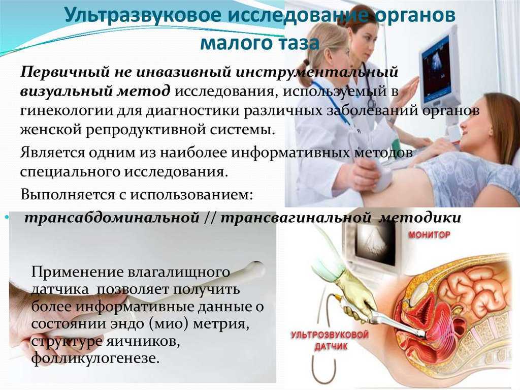 Признаки овуляции